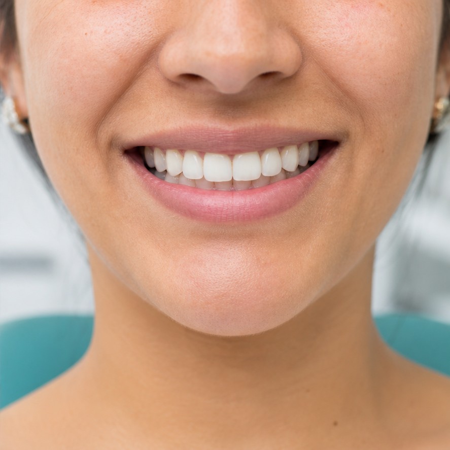 Sonrisa después del tratamiento